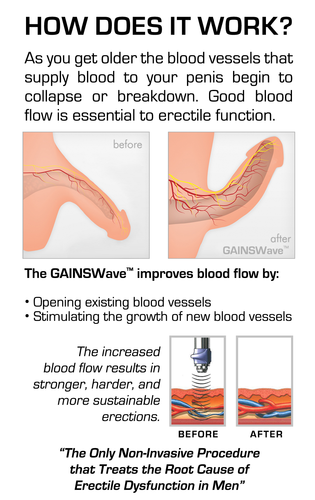 GAINSWave Sexual Wellness at Liquivida